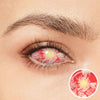Patient Zero Sclera Eyes