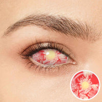 Patient Zero Sclera Eyes